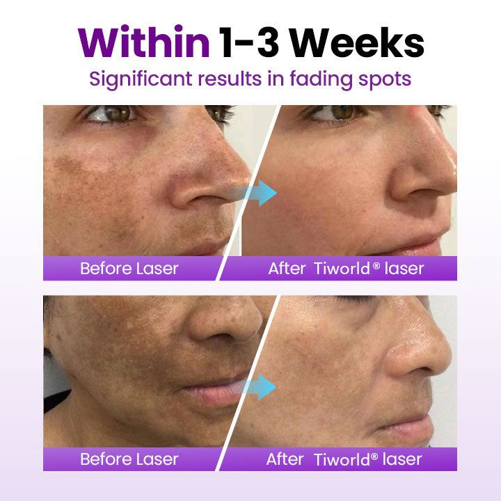 Tiworld® SpotErase Probiotic Shield Serum
