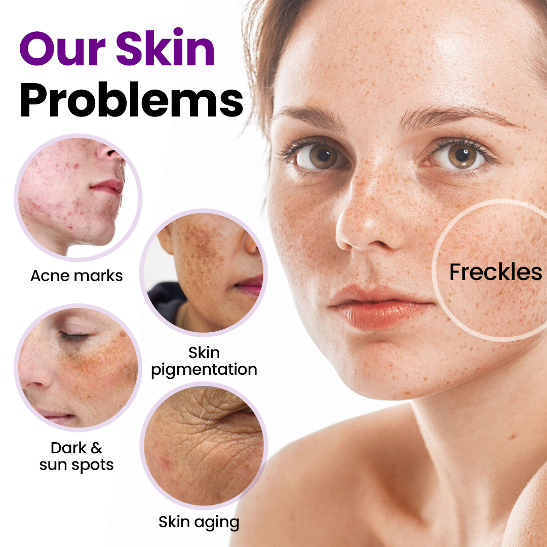 Tiworld® SpotErase Probiotic Shield Serum