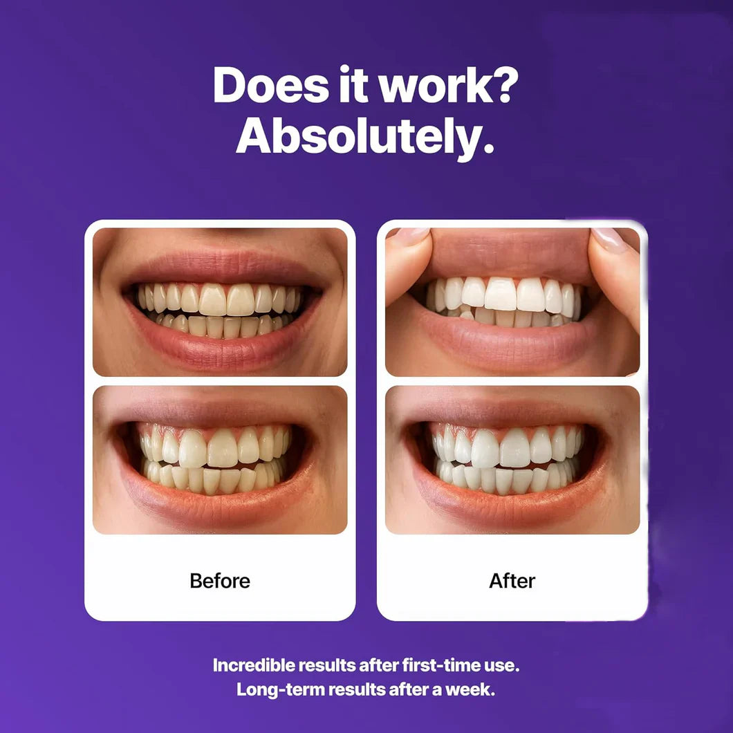 Yagoo® Whitening Strips