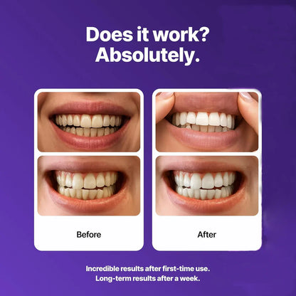 Yagoo® Whitening Strips